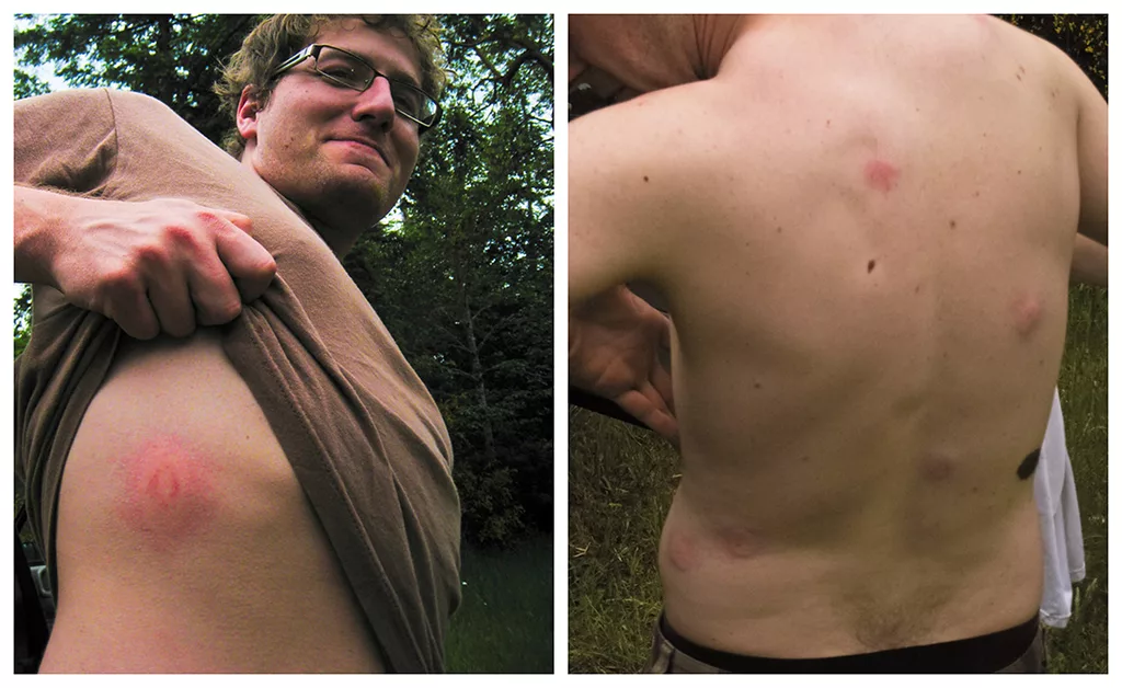 Heavy clothing weighs you down but helps prevent painful welts like these.
